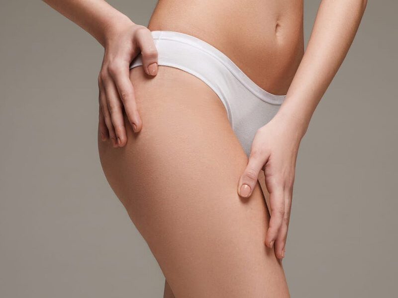 1. Thigh Lift Surgery: Your Complete Preparation Guide